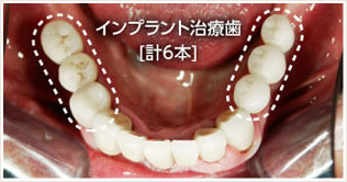 メインテナンス