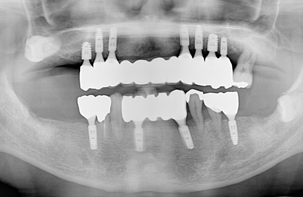 レントゲン画像